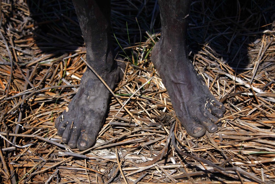 澳大利亚东阿纳姆地原住民保留地，雍古族原住民猎手Robert Gaykamangu的脚。