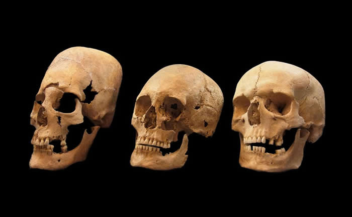 德国南部1400年历史的墓葬出土的头骨有明显较高（图左）而圆（图中）的颅骨塑形，研究人员相信这是来自更东边部族的文化习俗。 PHOTOGRAPH BY STAT