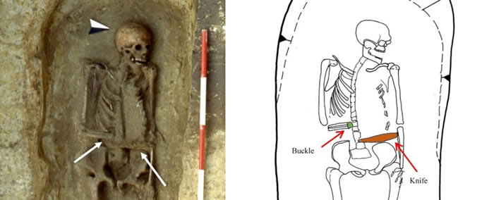 《人类学杂志》：意大利伦巴底古墓中发现世界上第一个赛博格