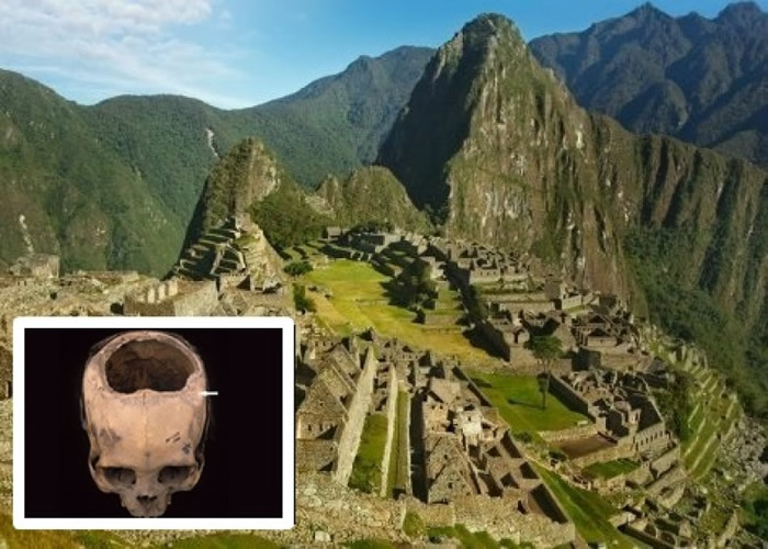 美国科学家研究秘鲁古印加帝国时期古印加人头颅骨 开颅技术胜美内战时期