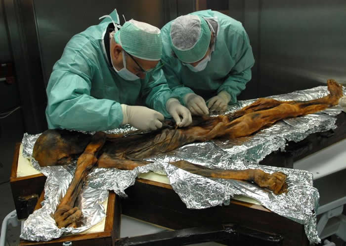 研究人员为冰人奥茨（Ötzi the Iceman）胃中的内容物取样，以查出他最后一餐到底吃了什么物种的动植物。 PHOTOGRAPH COURTES