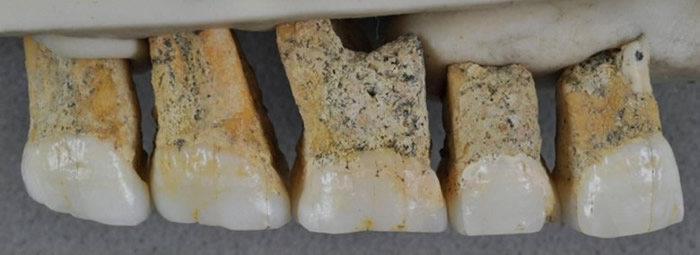 吕宋人的臼齿与前臼齿的比例与其他人种不同。