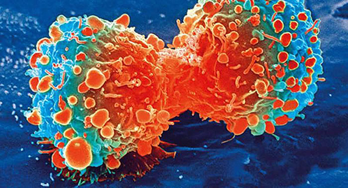耶鲁大学科学家提出一种激活免疫系统治疗恶性肿瘤新方法