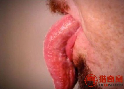 　　世界最长舌：英国长舌男舌长9.8厘米