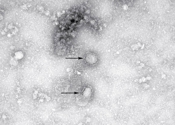 在武汉肺炎爆发前美国科学家曾利用电脑模拟巴西猪场爆发新型冠状病毒“CAPS”
