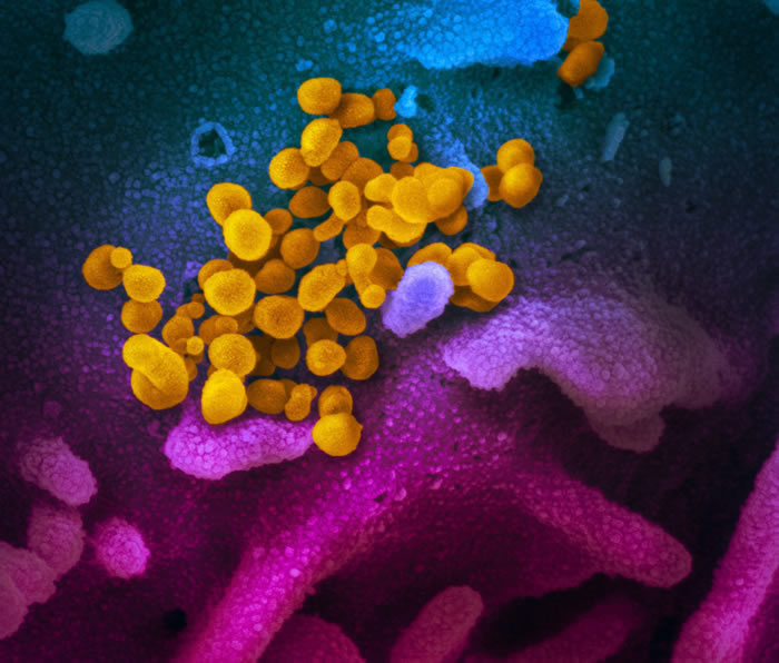 美国过敏与感染疾病中心（NIAID）发布新冠病毒影像 与一般冠状病毒相似