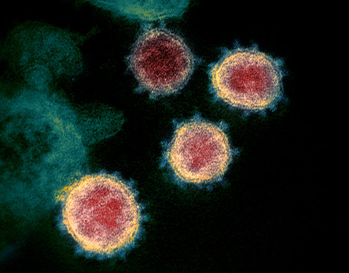 新型冠状病毒肺炎是“动物源性病毒” 空气传播不是主要传播方式