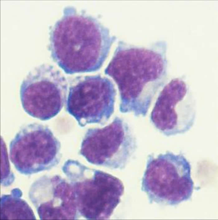 经过基因工程改造的骨髓细胞在小鼠中减缓了前列腺和胰腺癌细胞的生长