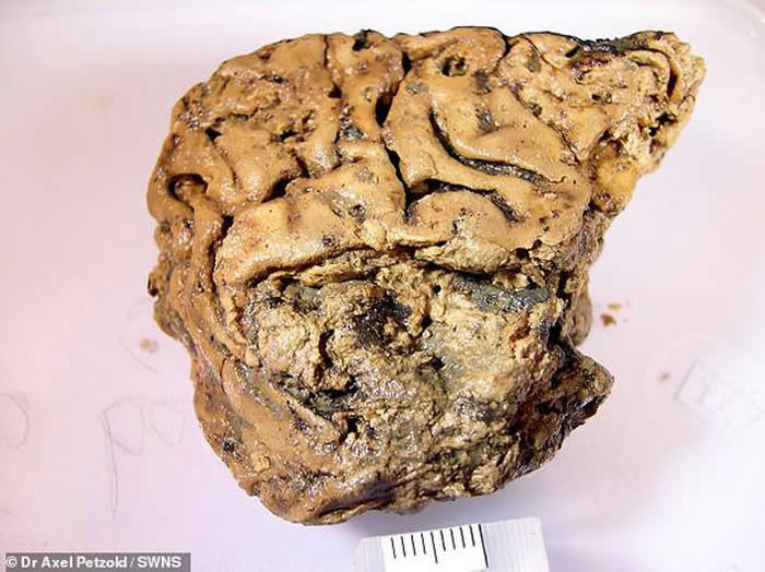 这个被称为“赫斯灵顿大脑”的古人类大脑保存非常完好，是2008年考古学家在英国约克郡附近的赫斯灵顿村一处泥坑中发现的。