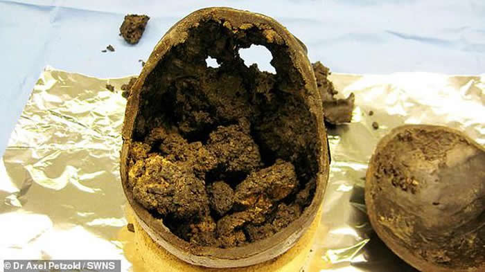 这个被称为“赫斯灵顿大脑”的古人类大脑保存非常完好，是2008年考古学家在英国约克郡附近的赫斯灵顿村一处泥坑中发现的。图中黄色部分是“赫斯灵顿大脑”。