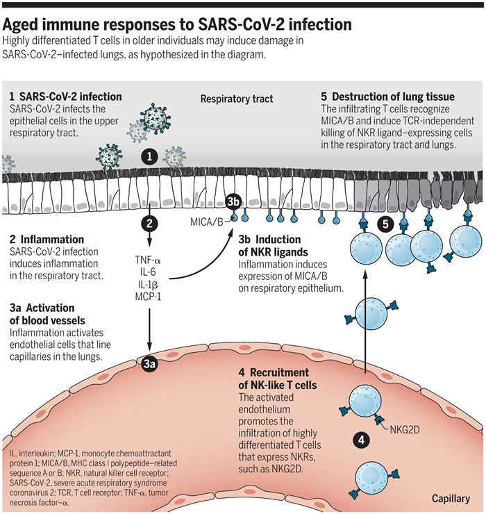 年龄较长者感染SARS-CoV-2的严重程度和死亡率增加可能与衰老性炎症有关