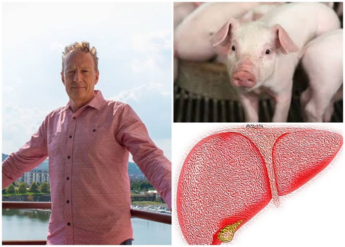 美国研究人员将肝脏干细胞注射到猪只淋巴结 成功培植出肝脏