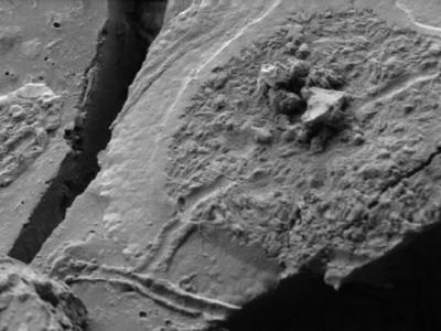 意大利科学家发现公元79年维苏威火山喷发时遇难者的大脑神经元