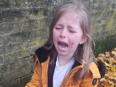 英国约克郡哈利法克斯市5岁小女孩放学不小心跌倒惨吃狗屎