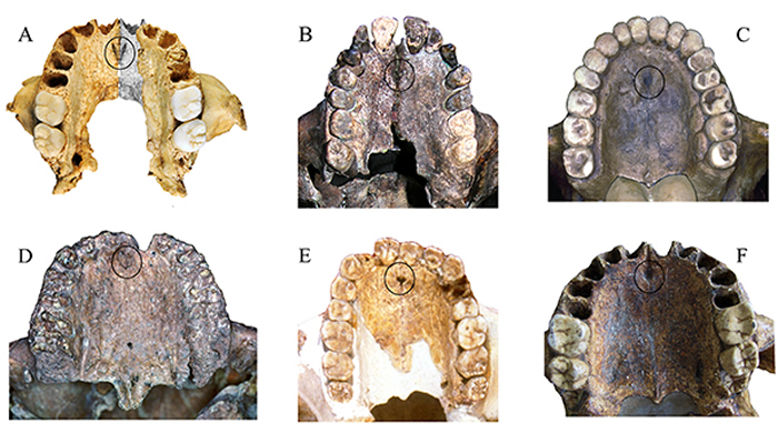 华龙洞6号与部分古人类化石硬腭部门齿孔位置(A) 华龙洞6号; (B) 非洲直立人(KNM-WT 15000); (C) 周口店直立人; (D) 摩洛哥中更新世