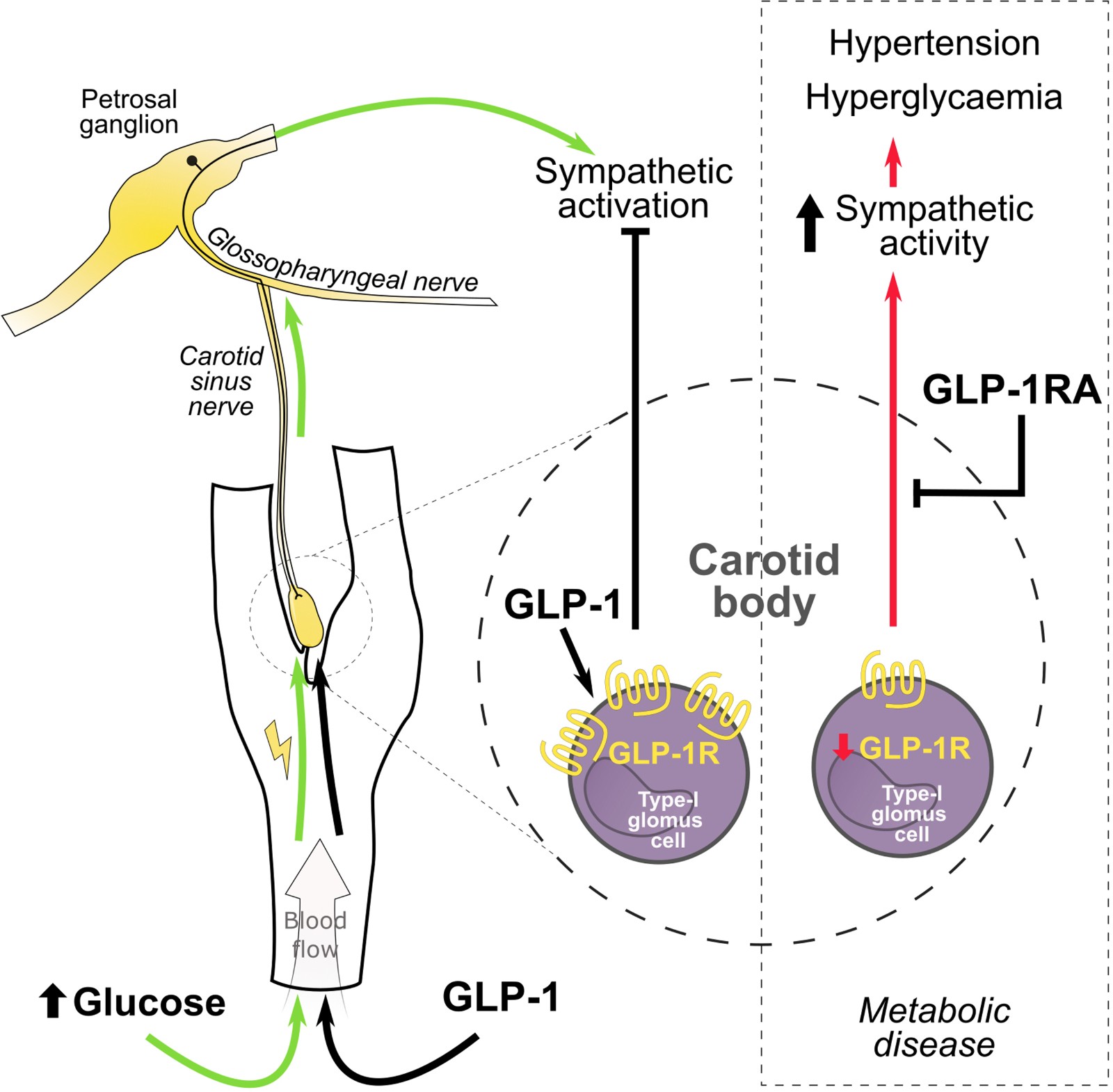 《Circulation Research》：新研究发现高血压和糖尿病之间的联系