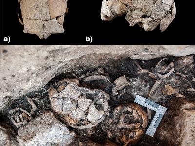 西班牙埃尔潘多尼斯巨石阵发现的人类头骨研究显示最早的耳科手术发生在5300年前